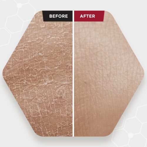 Alternative view of SKIN1004 Zombie Beauty Bloody Peel AHA un BHA 17% skābju pīlings sejai