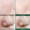 SOMEBYMI_AHA_BHA_PHA_30_Days_Miracle_Toner_Nudie_Glow_Korean_Beauty_Skincare_Australia_before_after_800x