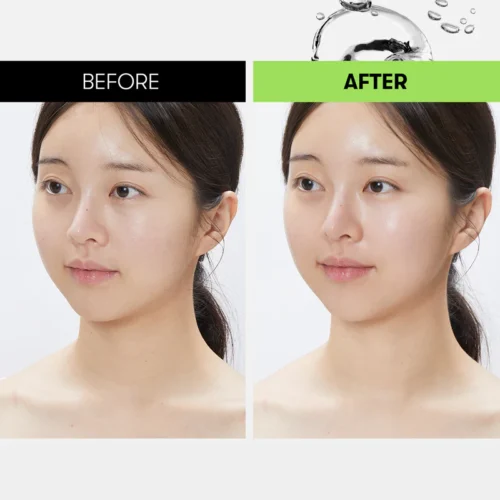 Alternative view of VT Cosmetics Reedle Shot Synergy Sparkling Toner Pad tonizējošas plāksnītes sejas attīrīšanai