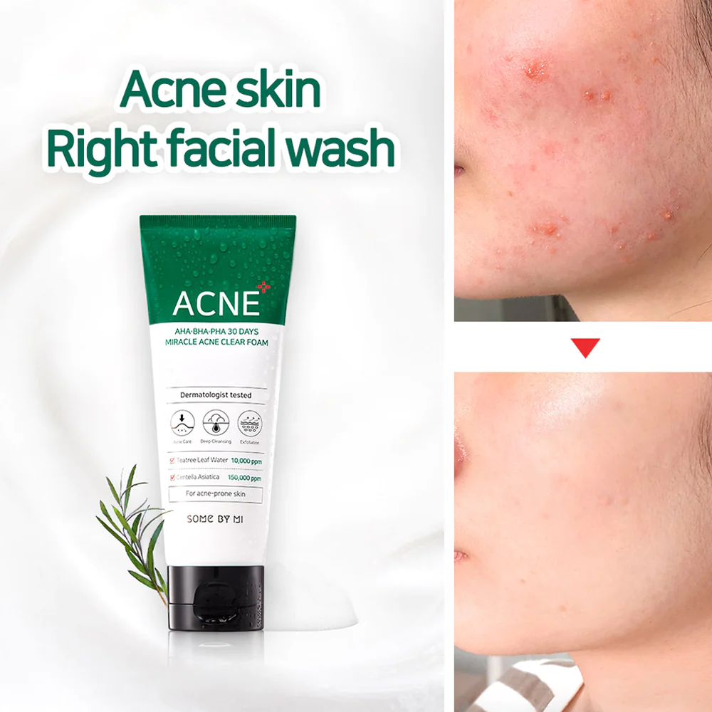 AHA_BHA_PHA_30_Days_Miracle_Acne_Clear_Foam2.png-1