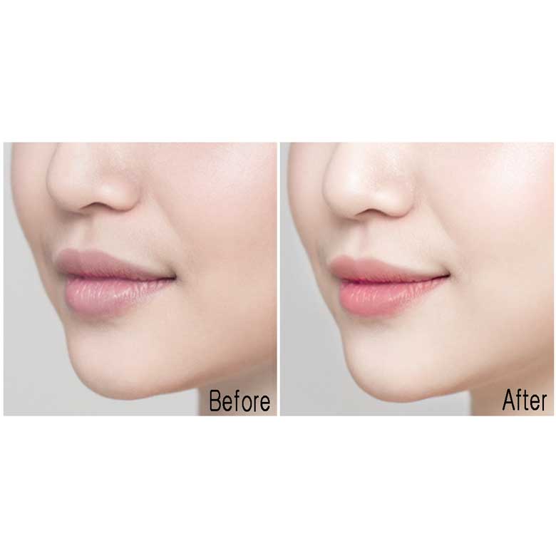 3b1be3f55e70f9bb41a1c7e38f6ed08e007a3c87_original