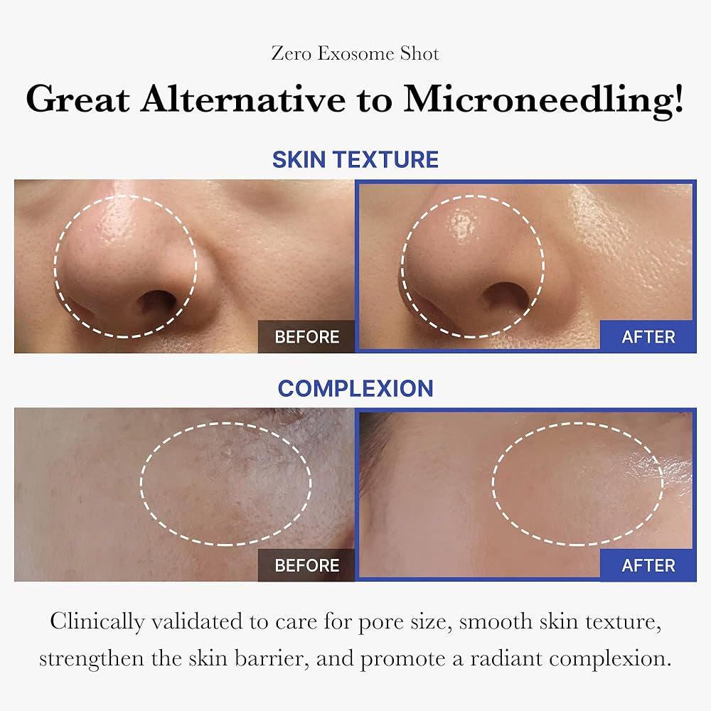 71pkV2LK5wL._AC_UF1000,1000_QL80_