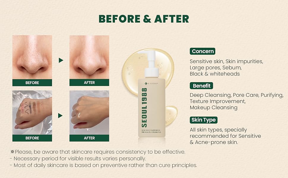 000d8af2-fd4a-4f58-a9ce-10395134c8a8.__CR0,0,1940,1200_PT0_SX970_V1___