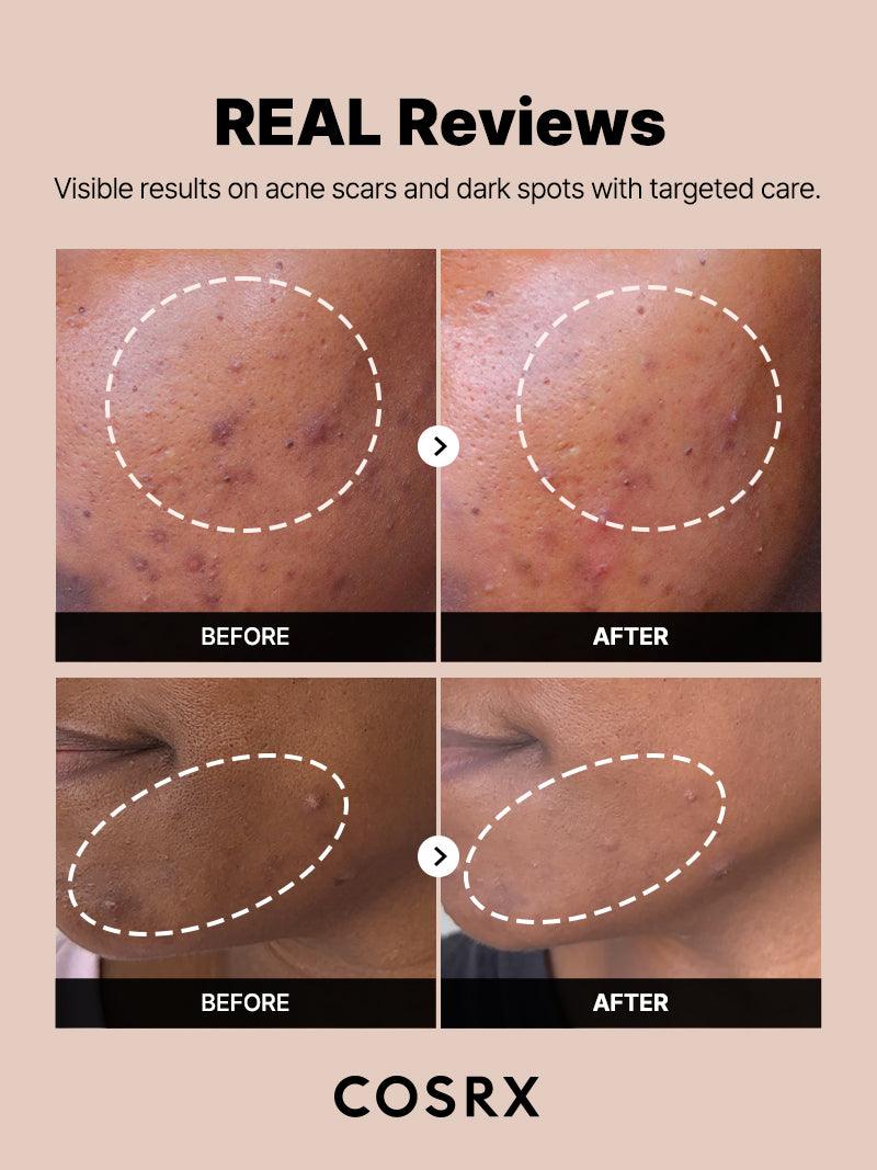 The-Alpha_arbutin_2_Serum_19__2_A_2048x