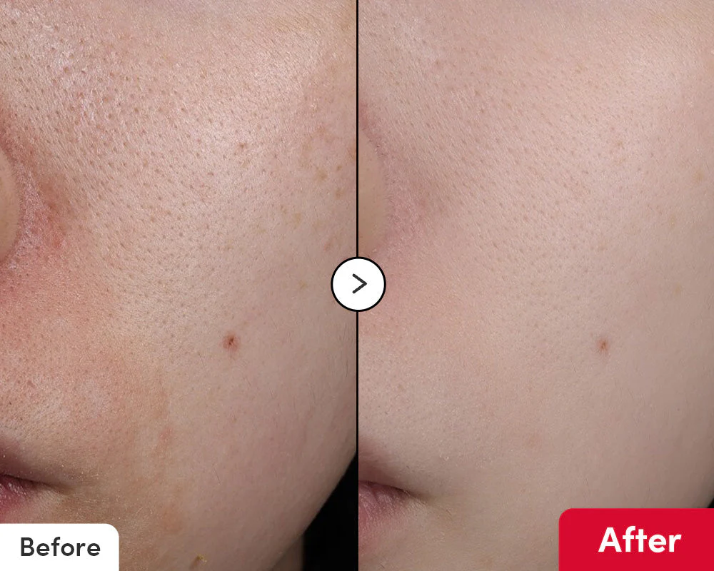 eqqualberryvitaminCserum_3