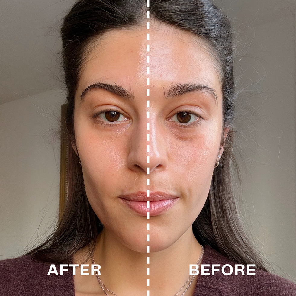 beforeafter-6746129aafbf6