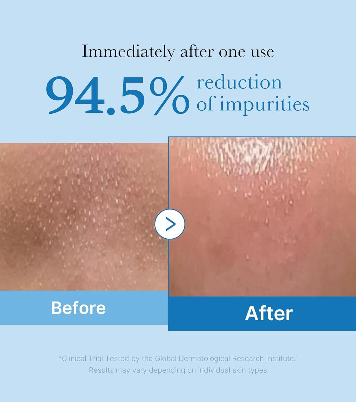 medicube-zero-pore-aceite-limpiador-blackhead-deep-3-88828