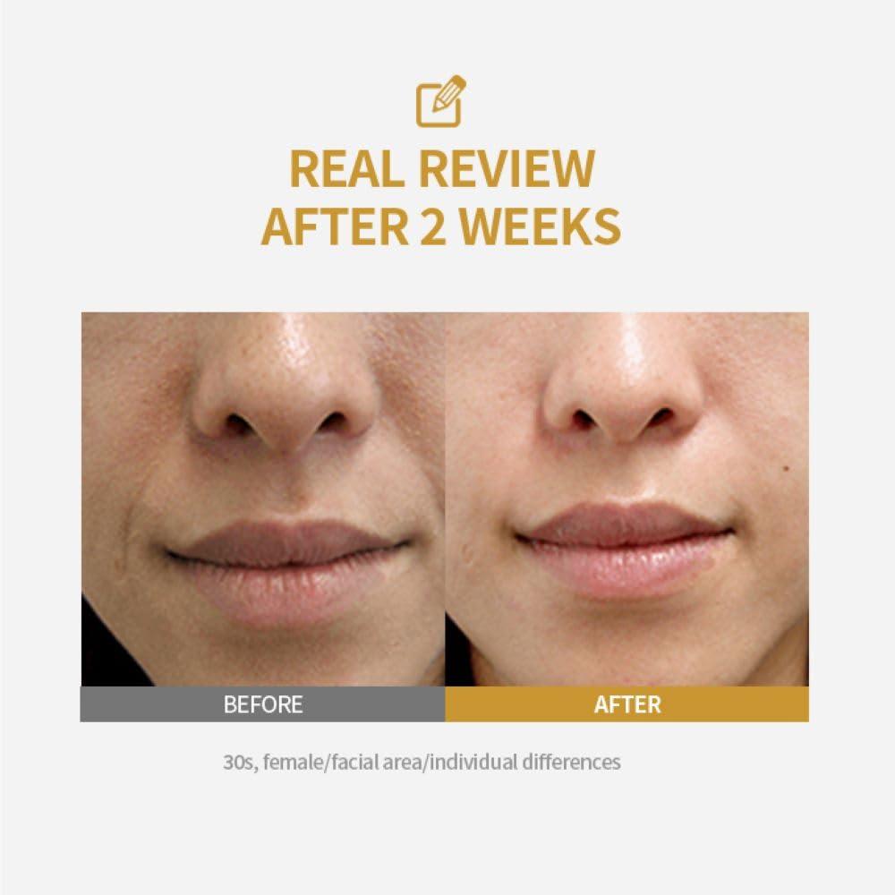 51yabYzTQYL.-SL1000--14145